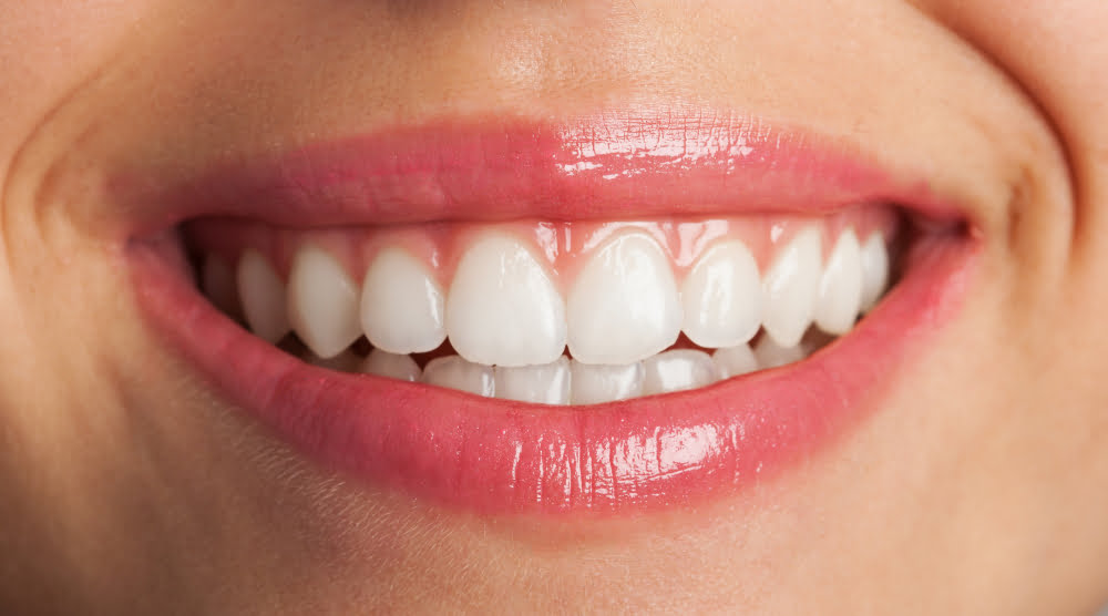 6 tipos de Estética para os Dentes para dentes bonitos 1 Estética para os Dentes