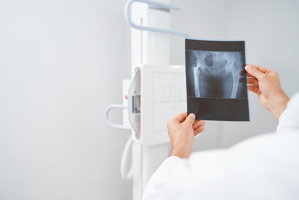 Exame de Imagem: Quais os mais comuns? 1 radiografia